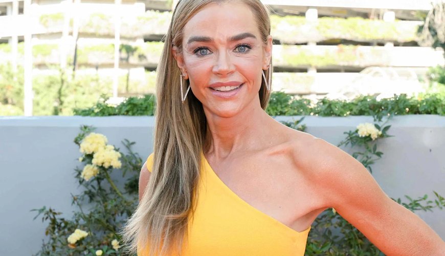 Denise Richards Reveals Stunning Facelift Transformation and Embraces Transparency
