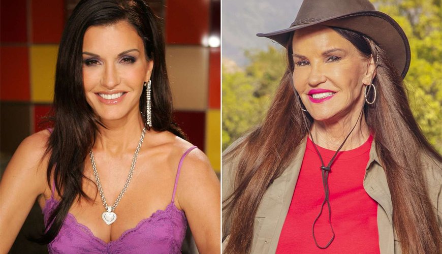 Janice Dickinson's High-Stakes Drama: The Fall That Scarred Her